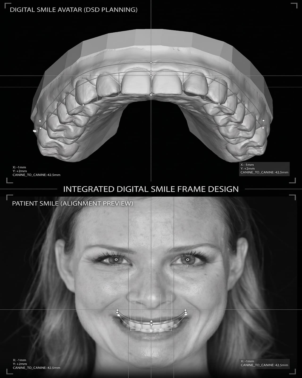 Digital Smile Design